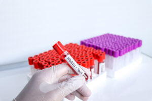 HbA1c, or Hemoglobin A1c,blood,sample