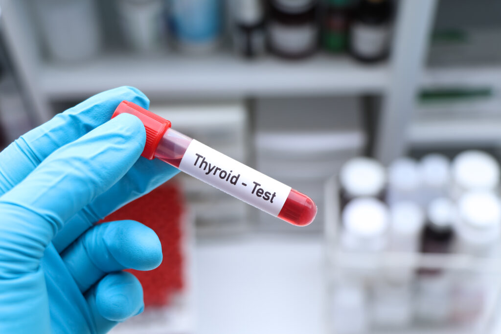 Thyroid