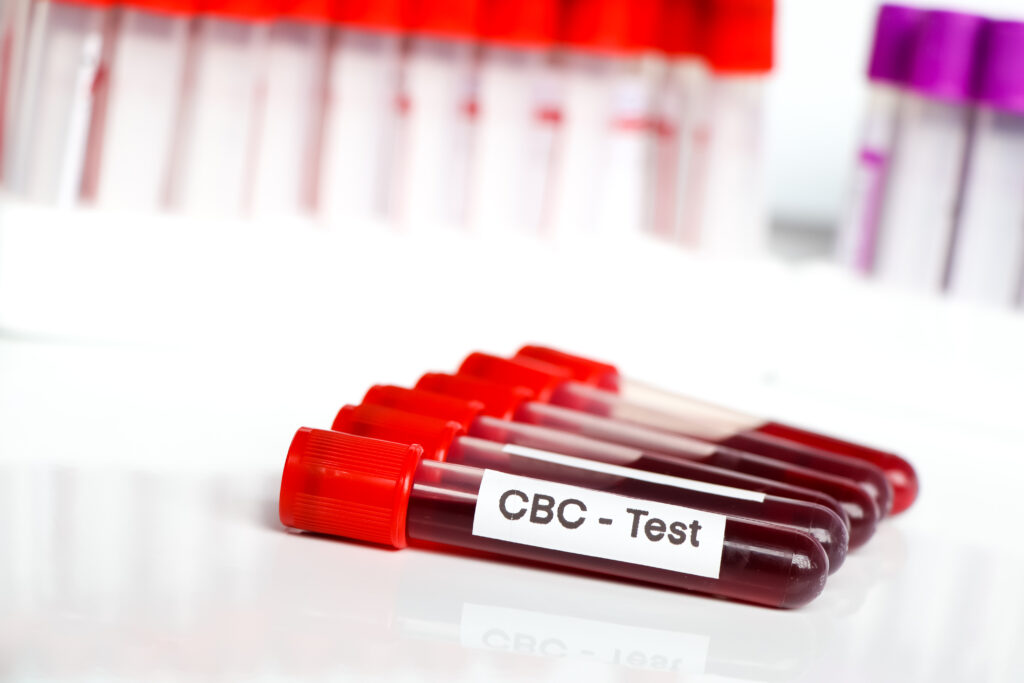 medical, complete blood count, cbc
