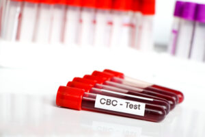 medical, complete blood count, cbc