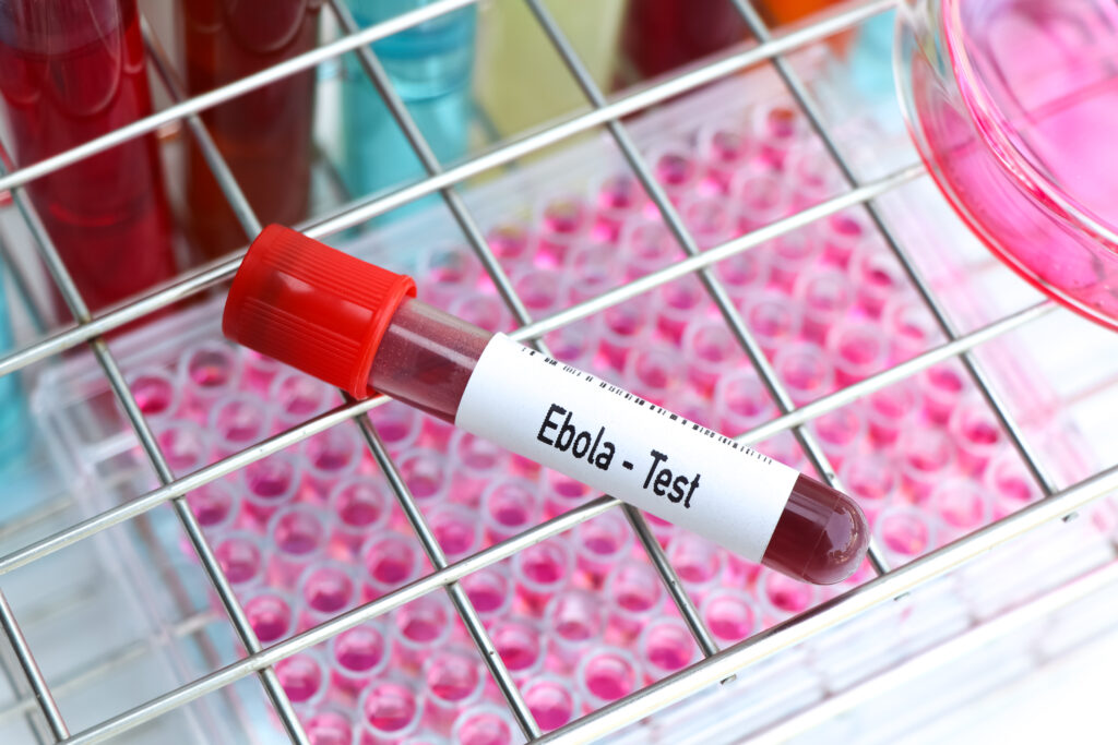 Ebola