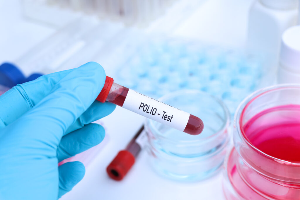 POLIO, Poliomyelitis