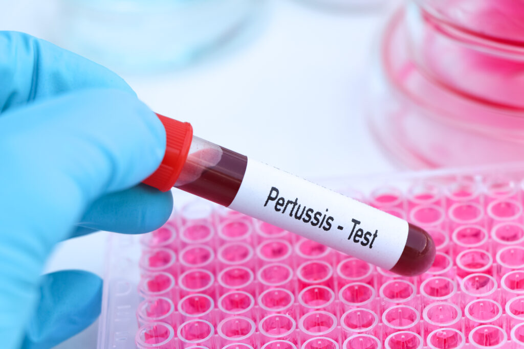 Pertussis