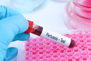 Pertussis