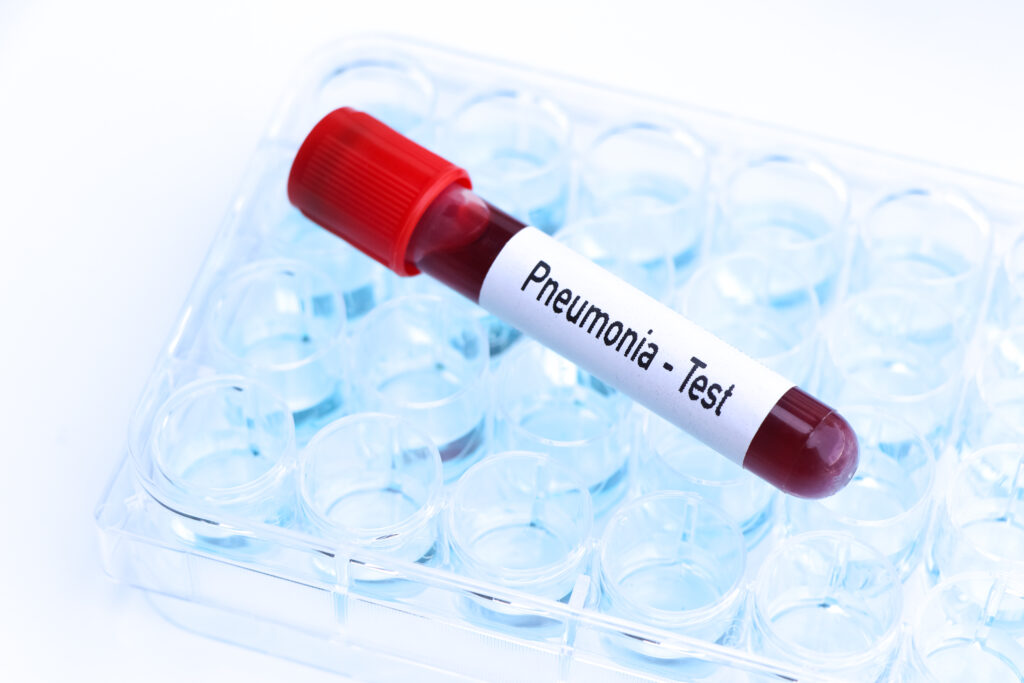 Pneumonia