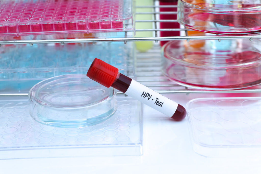 human papillomavirus, hpv