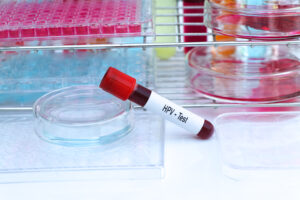 human papillomavirus, hpv