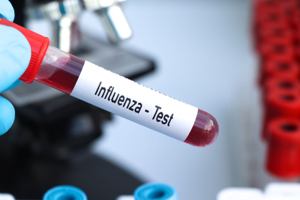 Influenza