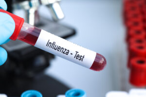Influenza