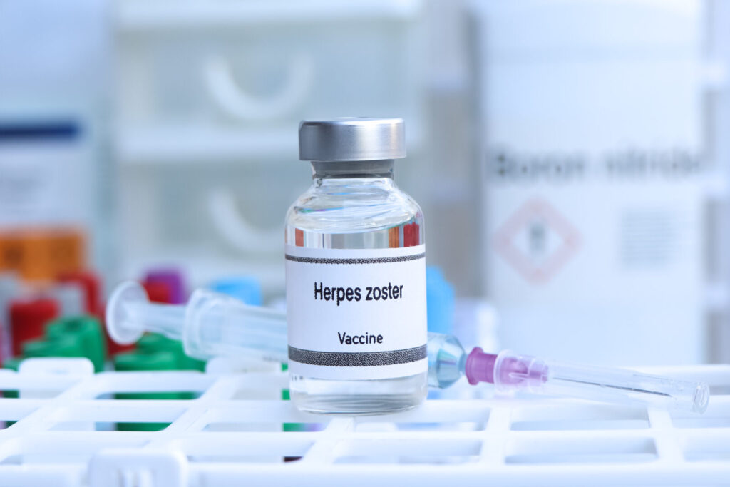 Herpes zoster