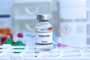 Herpes zoster