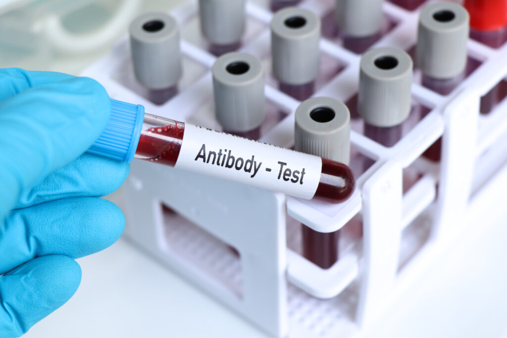 Antibody
