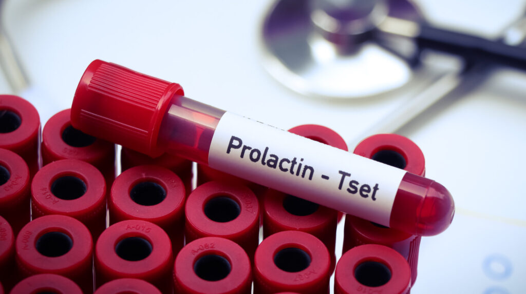 Prolactin